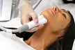 Enhance Your Skin with One or Three Venus Legacy Radio Frequency Skin Tightening Treatments at LightRx - Second Medium