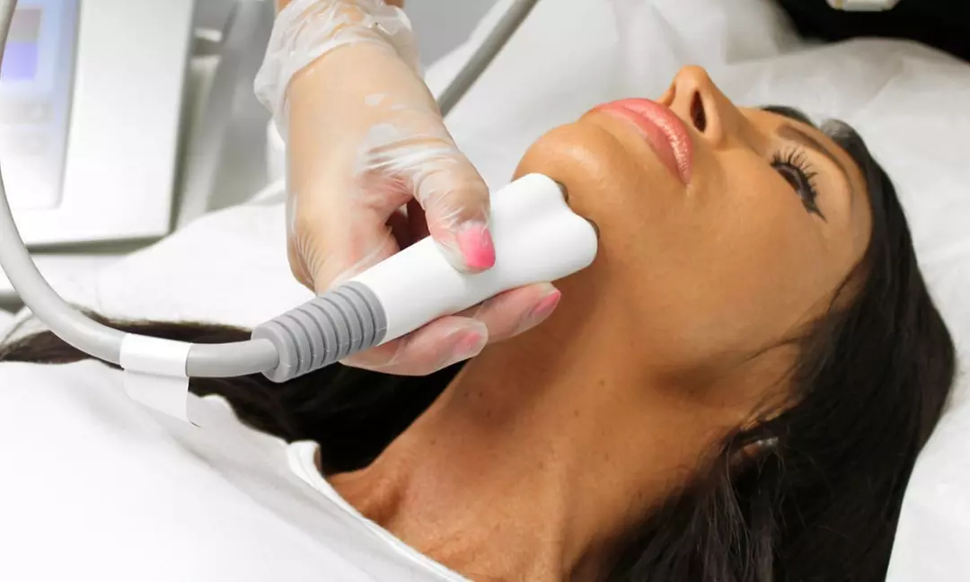 One or Three Laser Skin Tightening Sessions for Face Neck & Body Areas
