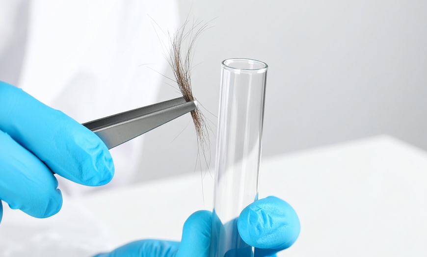 Image 2: Teste deine Lebensmittelverträglichkeit von bis zu 900 Lebensmitteln