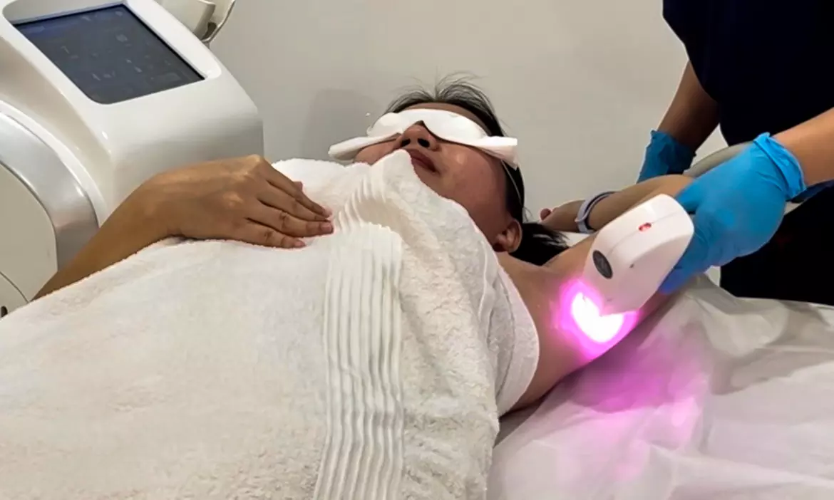 One Session of Laser Hair Removal on Two, Three or Four Areas