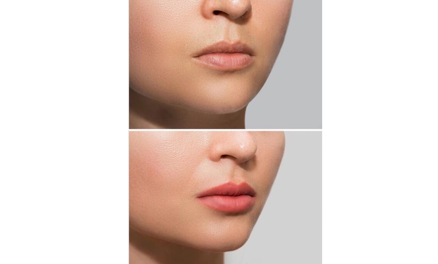 Image 9: Enhance Your Lips with a Lip Blushing Session