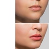 Image 9: Enhance Your Lips with a Lip Blushing Session