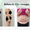 Image 1: Emerald Laser Fat Loss - Up To 4 inches Loss