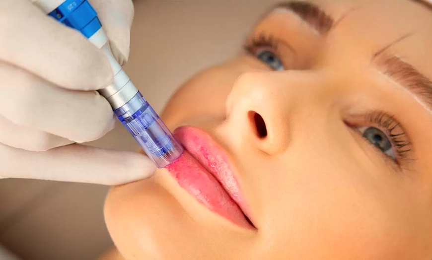 Image 14: Limpieza facial con tratamiento antiarrugas, hydralips, relleno y más