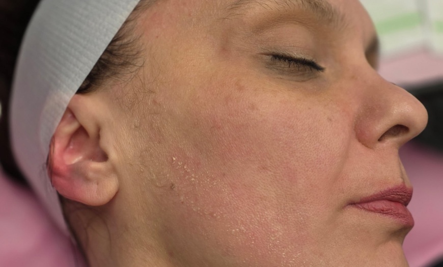 Image 4: 60 or 80-minute Procell Therapies Face and Optional Neck and More