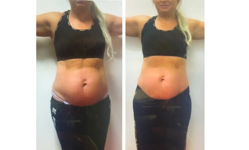 Image 2:  One or Two 60 or 90 Min Lymphatic Massage with Optional Sauna Detox