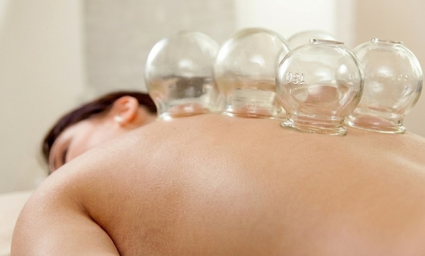 Image 2: Acupuncture Consultation and Treatment