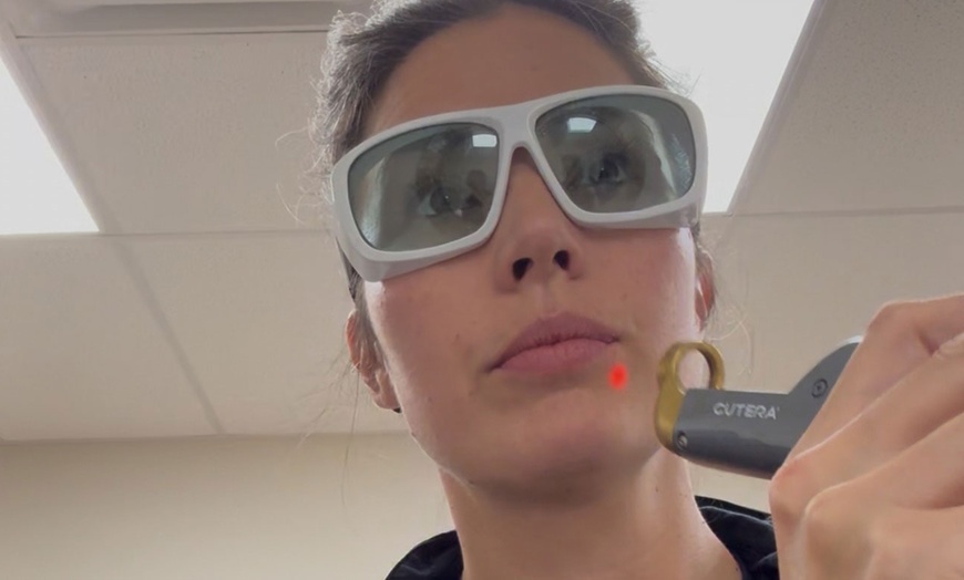 Image 6: Glow, Lift, And Renew With Laser Genesis, RF, PRP, And Tone Sessions