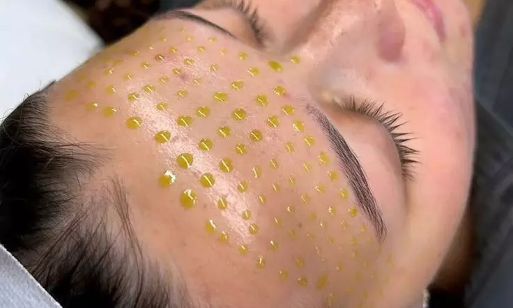 Odmień swoją cerę z zabiegami anti-aging: oczyszczanie, lifting, analiza skóry i więcej w Beauty studio Angel Touch - Primary Image