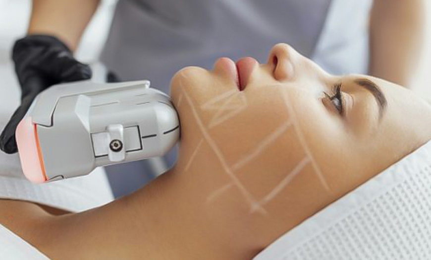 Image 6: Lift & Tighten: HIFU Neck, Half Face, Full Face, Neck, or Body