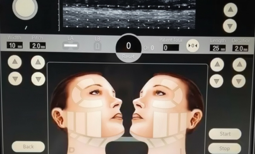 Image 1: Non-Invasive HIFU Face Neck or Intimate HIFU Skin Tightening