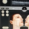 Image 1: Non-Invasive HIFU Face Neck or Intimate HIFU Skin Tightening