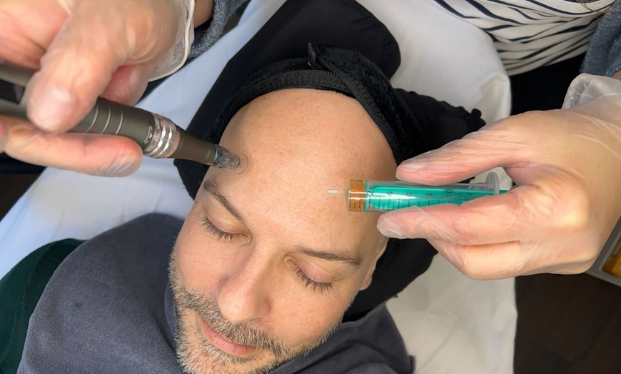 Image 2: Klassische Gesichtsbehandlung, Microneedling oder IPL 