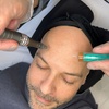 Image 2: Klassische Gesichtsbehandlung, Microneedling oder IPL 