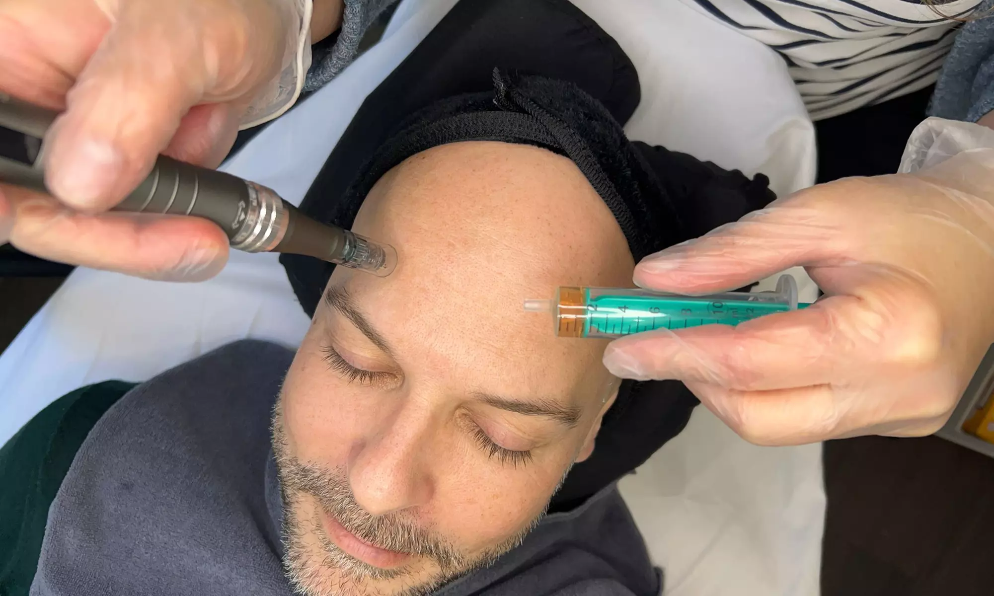 IPL, Exosomen, Microneedling & klassische Pflege – Hautpflege für dich