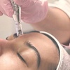 Image 1: One or Two Sessions of Microneedling or One or Three Sessions w/ Mask