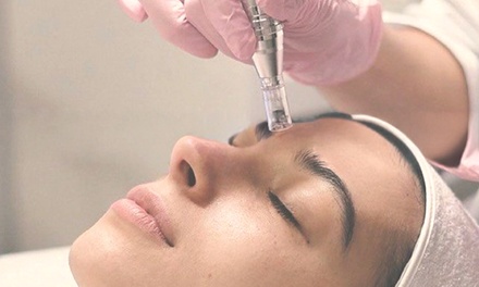 One Session of Micro-Needling - Skin & Ink