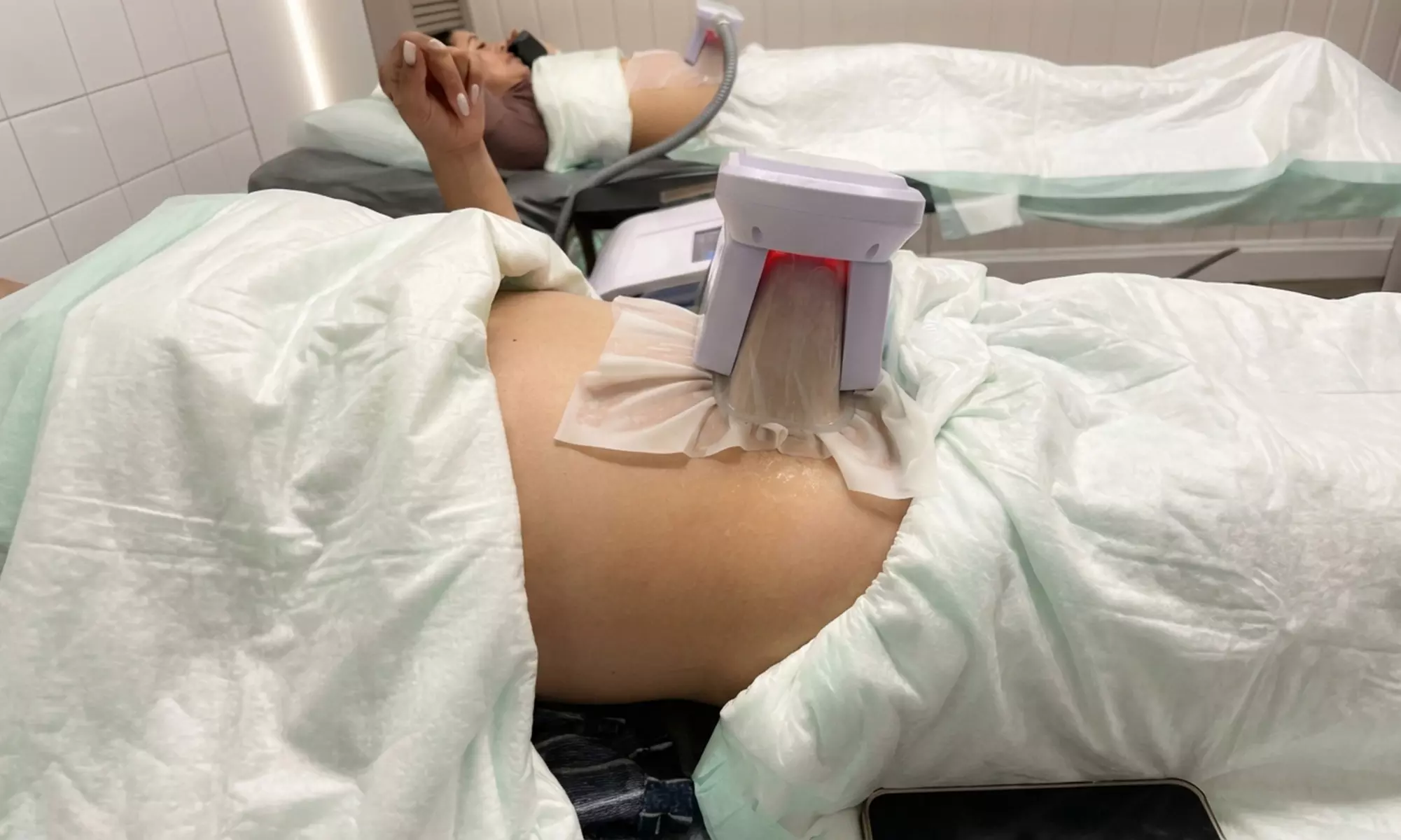 1, 3 or 5 UltraSlim IV Radio Frequency Skin Tightening Treatment for 1