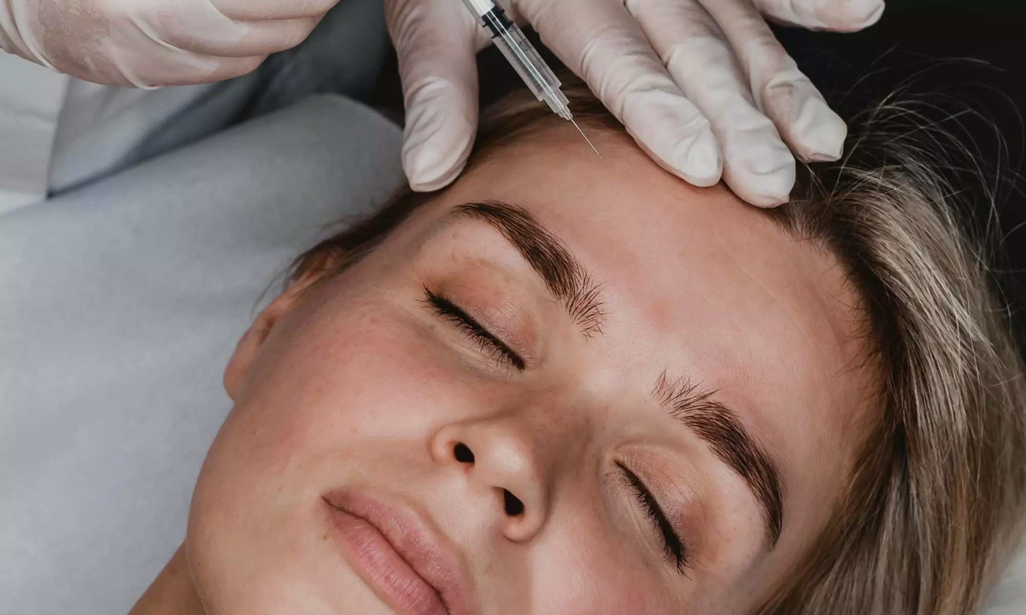 Up to 50% Off on Vampire Facelift at Skinbiotic Med Spa