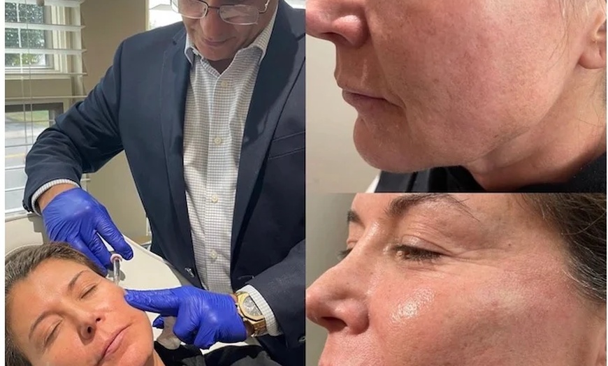 Image 3: Youthful Glow Awaits with 60 or 120 Units of Dysport 