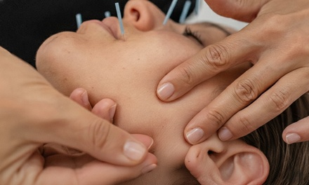 Acupuncture Masterclass - Compete High