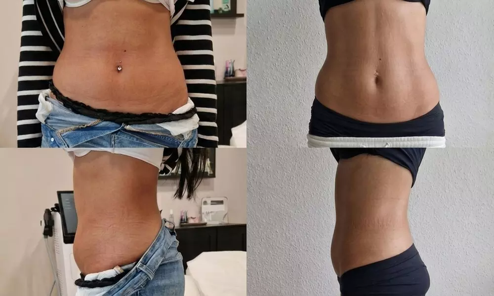 1 oder 2x 30 Min. EMS-Training mit ausführlichem Beratungsgespräch