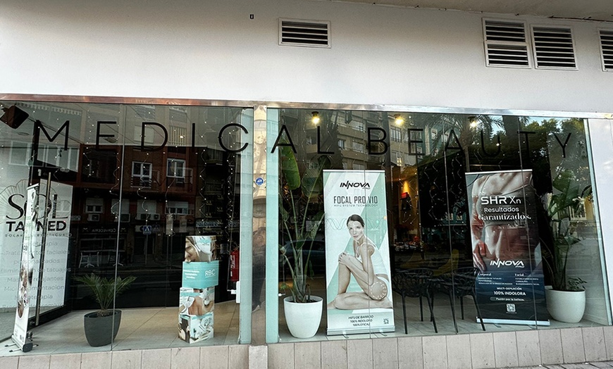 Image 12: 1 o 3 sesiones de fotorejuvenecimiento facial con láser IPL