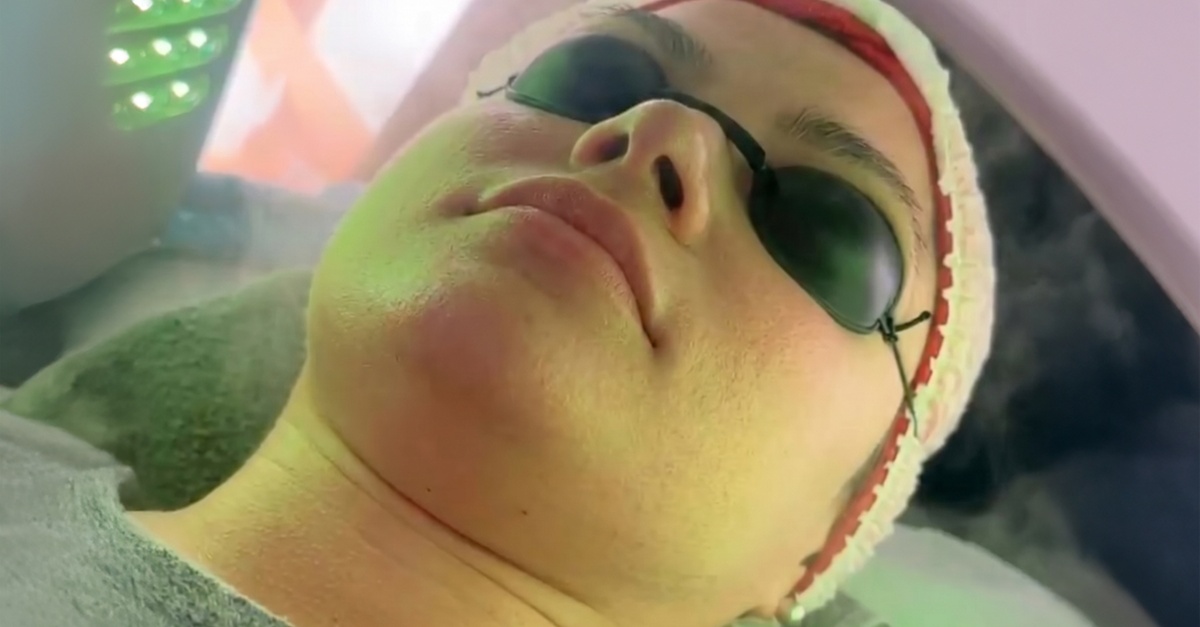 Tratamiento facial con dermapen, exosomas y terapia LED médica en Madrid