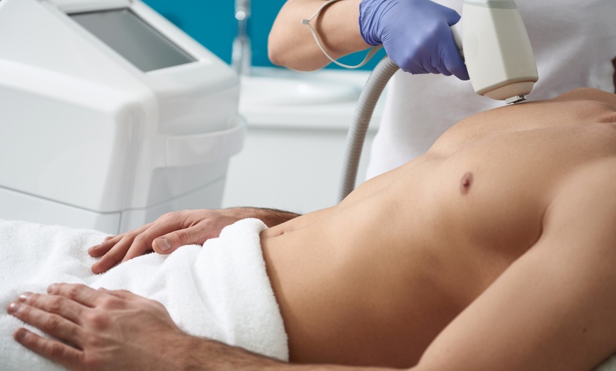 Image 3: ¡Bye, bye, pelitos! Depilación con láser de diodo Sapphire para 1