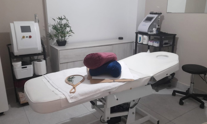 Image 2: 1 o 2 sesiones de mesoterapia facial con cóctel de vitaminas