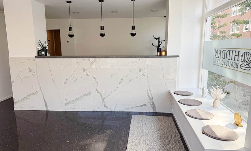 Image 2: Zichtbare versteviging zonder chirurgische ingreep