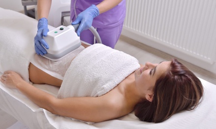 2 sesiones de criolipólisis - Marieta Divary Salon