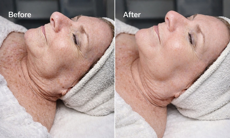 Image 3: Relax with One, Two, or Three 60-Minute Firming and Hydrating Facials
