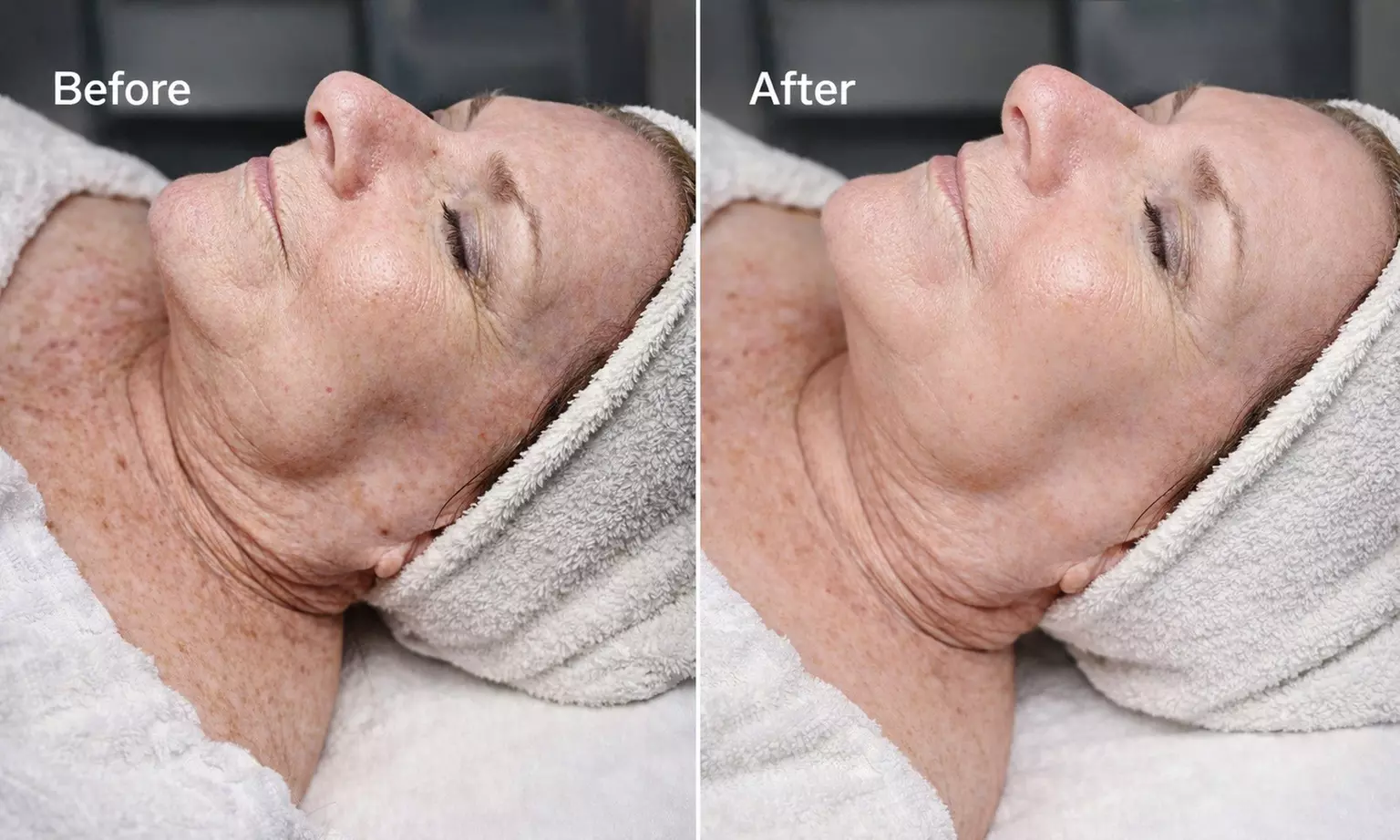 Relax with One, Two, or Three 60-Minute Firming and Hydrating Facials