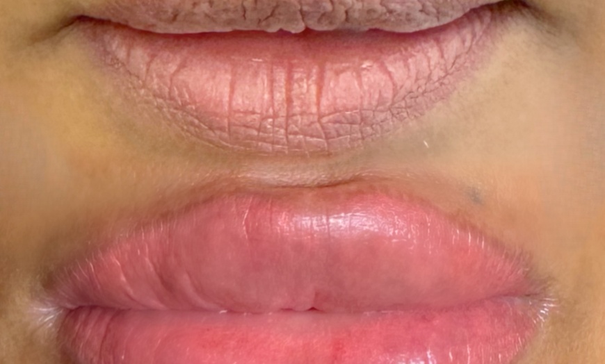 Image 2: Up to 42% Off on Permanent Makeup at Skin Clinic
