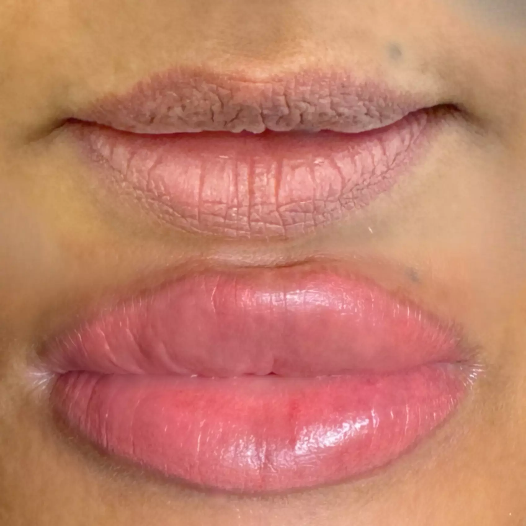 Achieve Perfectly Shaped Lips with Lip Blush Treatment