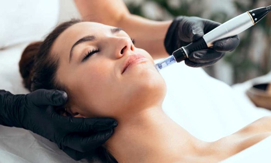 Image 6: Sesiones de rehidratación de labios, Dermapen facial y exosomas