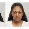 Image 3: 20 Units of Botox at BodyBrite Austin – Quick, Effective Results and Minimal Downtime - Up to 40%% Off