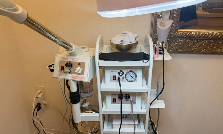 Image 3: One, Three or Five Microdermabrasion Facial Sessions for Smoother Skin
