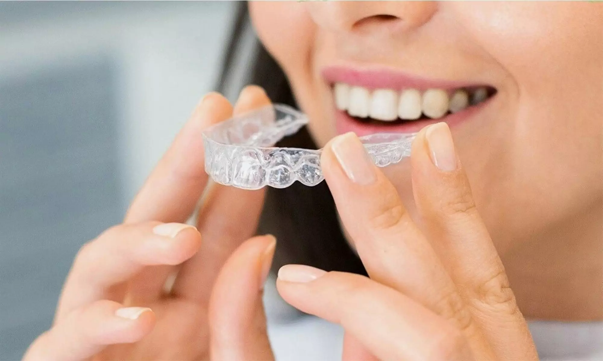 Dental Consultations: Invisalign, Implants & Exam with Cleaning
