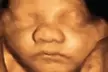 Exceptional Imaging Center offers Advanced 3D/4D, 8K Ultrasound Clarity For Detailed Views (Up to 53% Off) - Second Medium