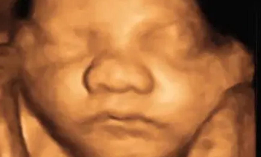 Image 2: See Your Baby In Amazing 3D/4D, 8K Ultrasound Clarity! 