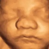 Image 2: See Your Baby In Amazing 3D/4D, 8K Ultrasound Clarity! 
