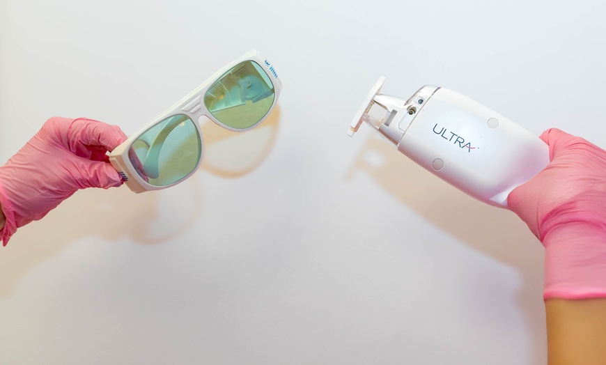Image 2: One or Three Laser Skin Resurfacing Treatment for a Fresh Glow