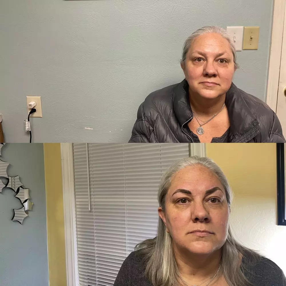 3D eyebrow microblading for beautifully defined brows