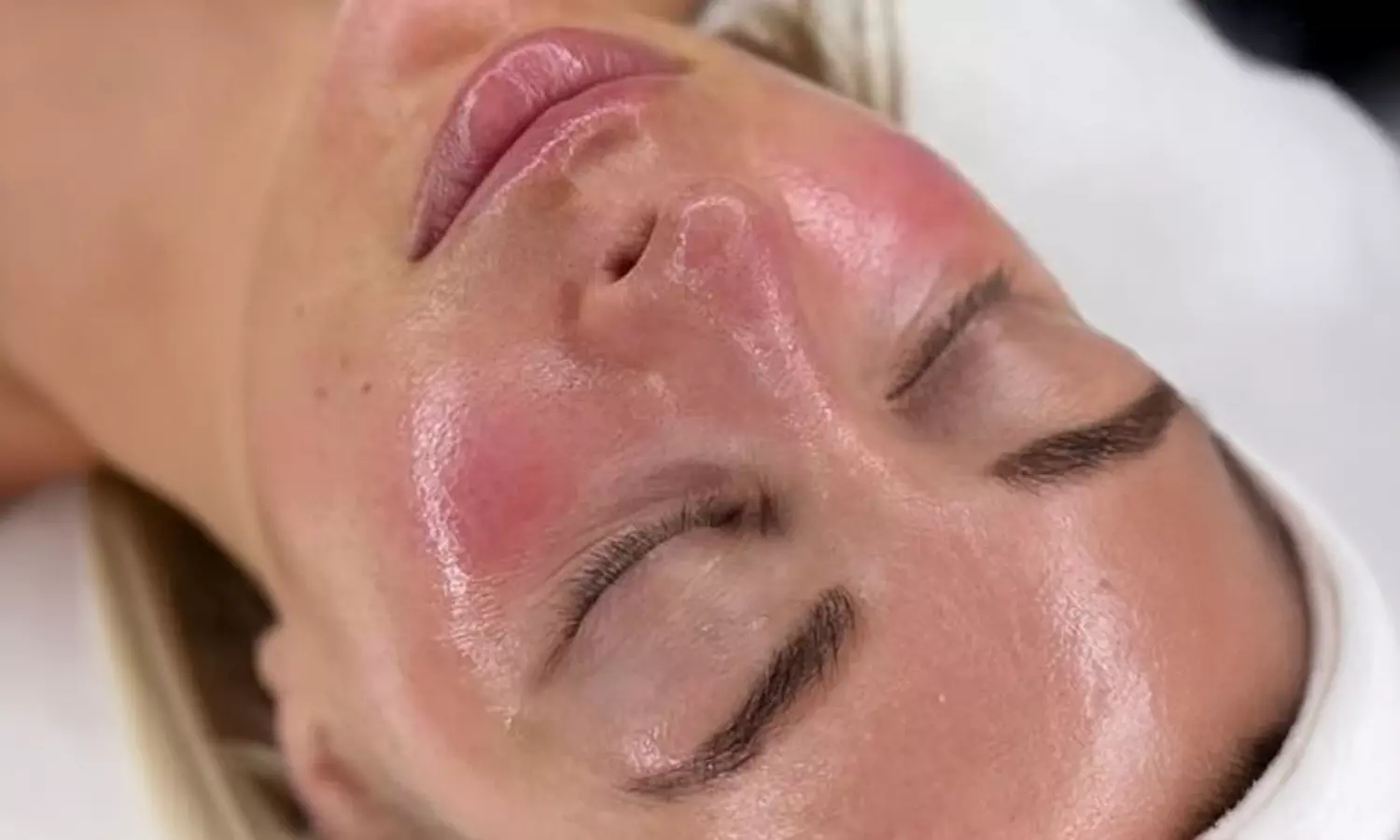 Programme expert pour une peau revitalisée