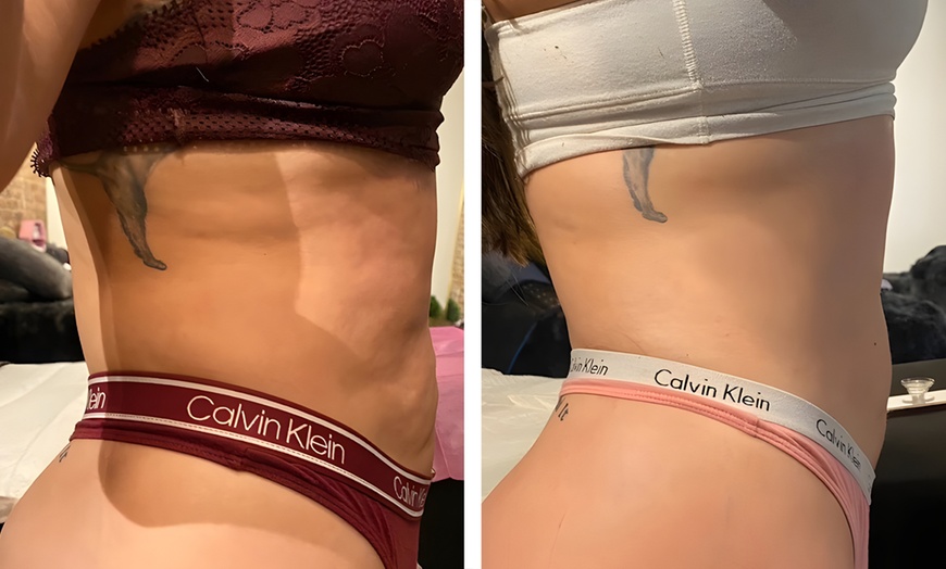 Image 3: 1, 3 or 6 Signature Body Contouring Sessions of Your Choice 45 -90 Min