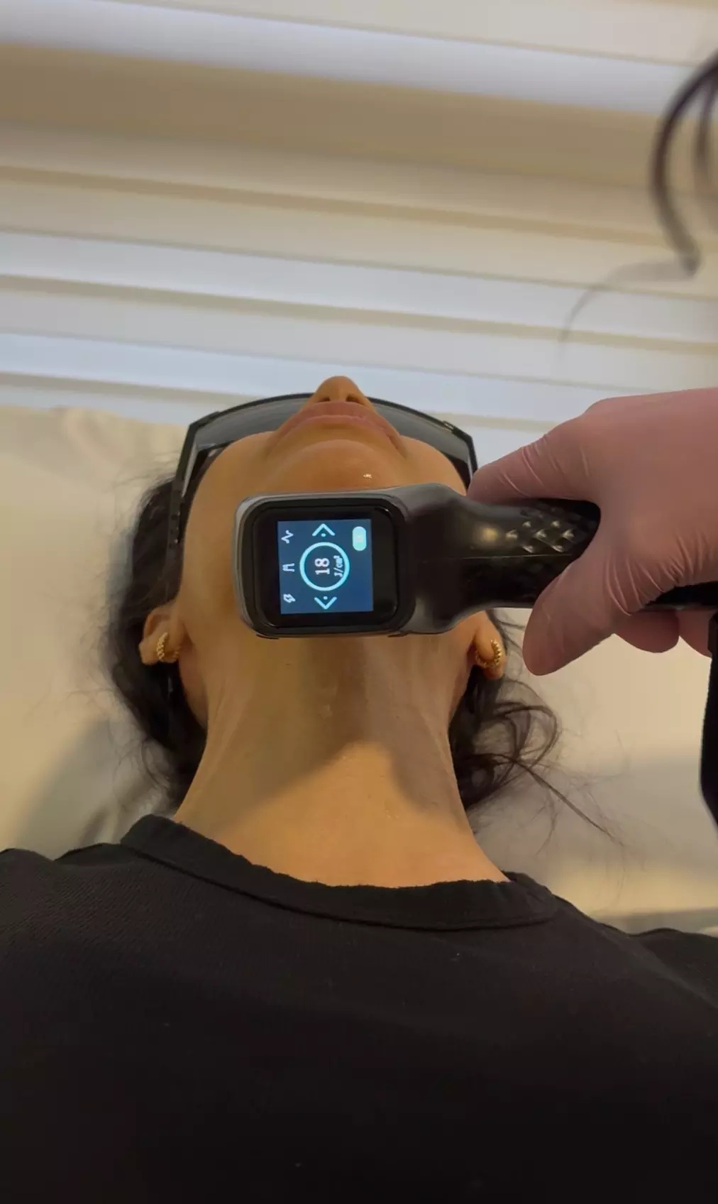 Laser Hair Removal - One Extra Large | Large | Medium | Small Area