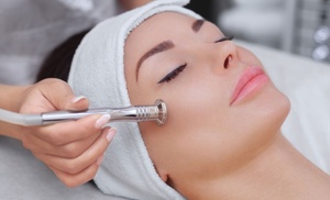 Up to 87% Off on Microdermabrasion at Love You Laser