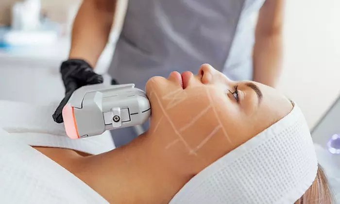 HIFU reafirmante en rostro, brazos, piernas o flancos